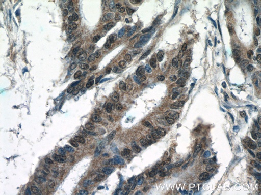 [24973-1-AP-20UL] KIAA0087 Polyclonal antibody