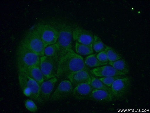 [24977-1-AP-20UL] C18orf21 Polyclonal antibody