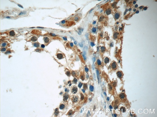 [24981-1-AP-20UL] FDXACB1 Polyclonal antibody