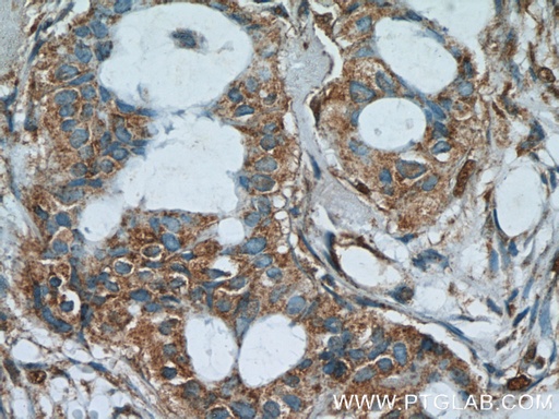 [24986-1-AP-150UL] AKAP4 Polyclonal antibody