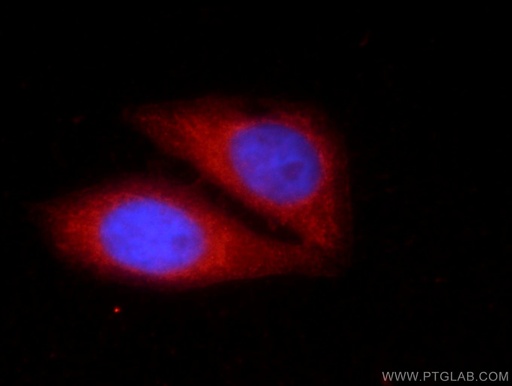 [24989-1-AP-150UL] KHDC3L Polyclonal antibody
