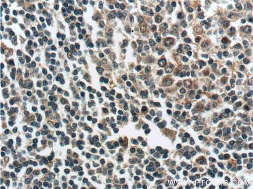 [24991-1-AP-20UL] ZC3H12D Polyclonal antibody