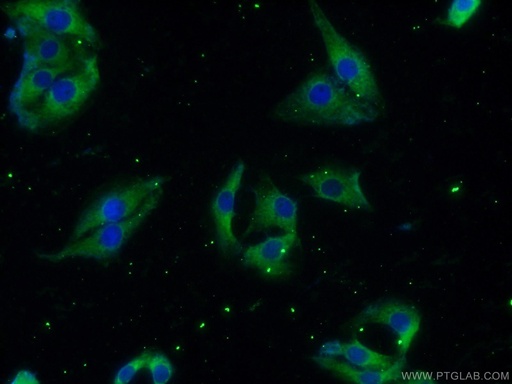 [24992-1-AP-150UL] HuD-specific Polyclonal antibody