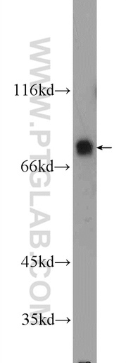 [25000-1-AP-150UL] SP2 Polyclonal antibody