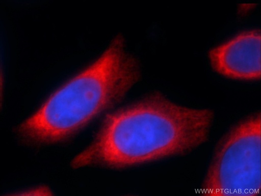 [25002-1-AP-150UL] RPL22 Polyclonal antibody
