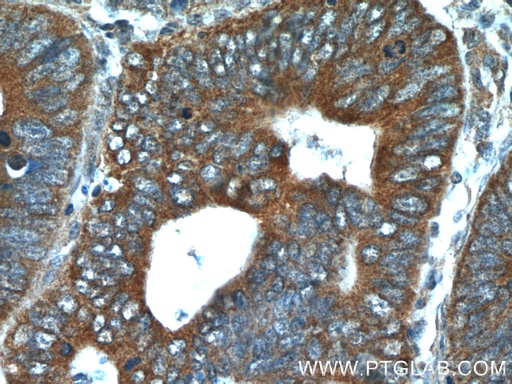 [25006-1-AP-150UL] FGFBP1 Polyclonal antibody