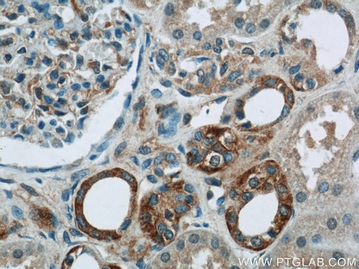 [25013-1-AP-20UL] PIPPIN Polyclonal antibody