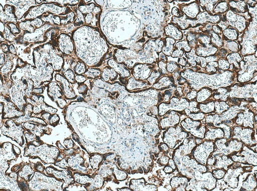 [25014-1-AP-20UL] hCG Alpha Polyclonal antibody