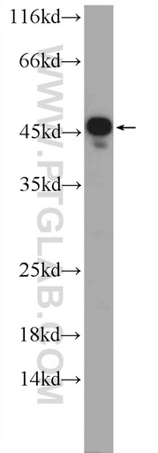 [25015-1-AP-20UL] SUMF1 Polyclonal antibody