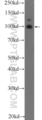 [25018-1-AP-20UL] TSHZ3 Polyclonal antibody