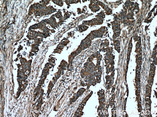 [25020-1-AP-20UL] C8orf48 Polyclonal antibody