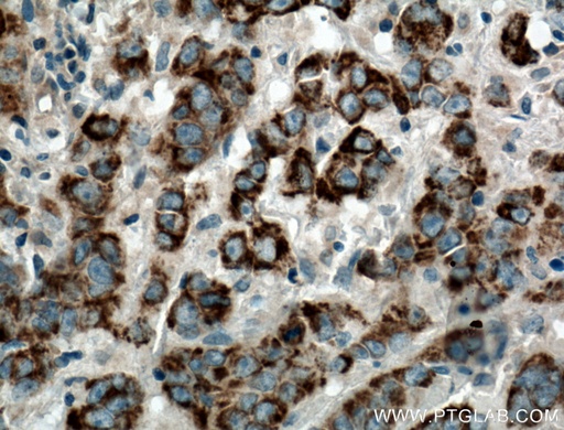 [25021-1-AP-20UL] DEC1 Polyclonal antibody