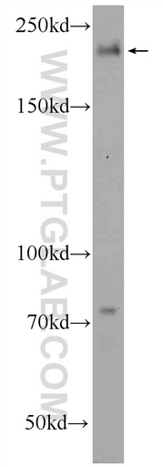 [25022-1-AP-150UL] GCP6 Polyclonal antibody