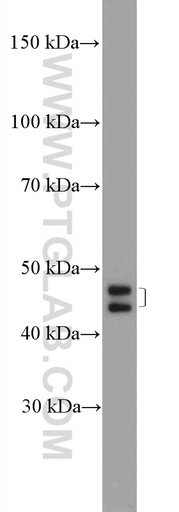 [25023-1-AP-20UL] ZNF586 Polyclonal antibody