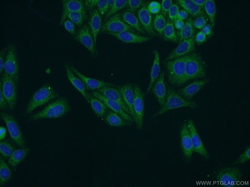 [25025-1-AP-20UL] NWD1 Polyclonal antibody