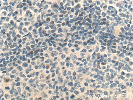 [25028-1-AP-20UL] MSC Polyclonal antibody