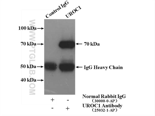 [25032-1-AP-150UL] UROC1 Polyclonal antibody