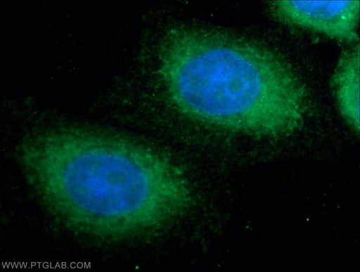 [25034-1-AP-150UL] ANKRD49 Polyclonal antibody