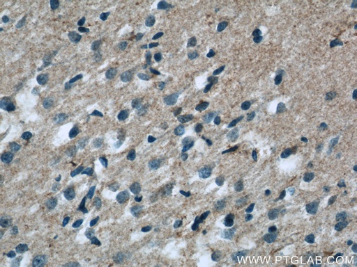 [25035-1-AP-20UL] ARMETL1 Polyclonal antibody