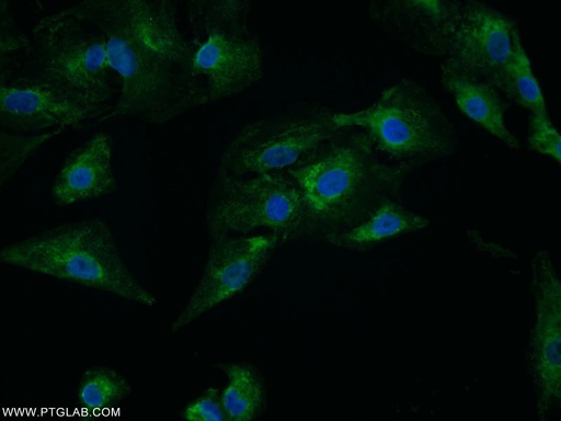 [25036-1-AP-150UL] C4orf29 Polyclonal antibody