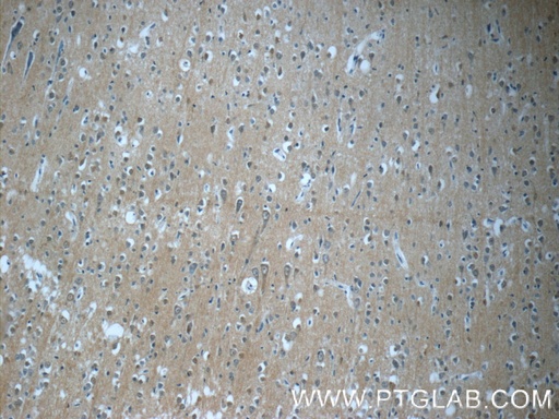 [25040-1-AP-150UL] TPPP Polyclonal antibody