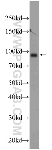 [25042-1-AP-150UL] TMCC2 Polyclonal antibody