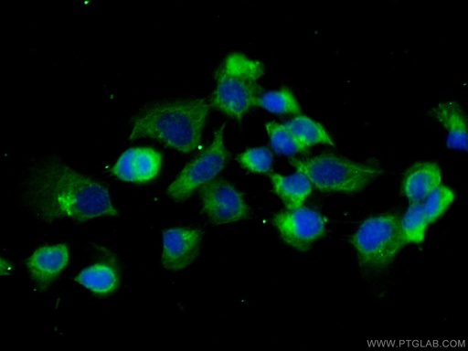 [25043-1-AP-20UL] CAPZB Polyclonal antibody
