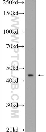 [25044-1-AP-150UL] HOXA2 Polyclonal antibody