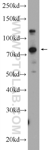 [25054-1-AP-150UL] KIAA1530 Polyclonal antibody