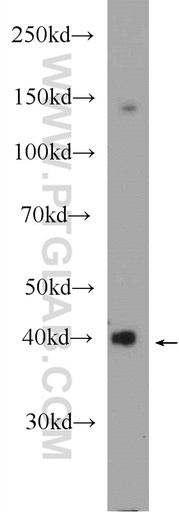 [25056-1-AP-20UL] HAO1 Polyclonal antibody
