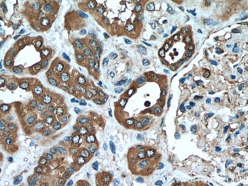 [25057-1-AP-20UL] CAPNS1 Polyclonal antibody
