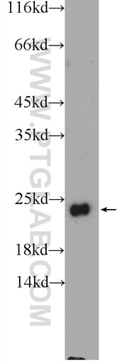 [25058-1-AP-150UL] FEV Polyclonal antibody