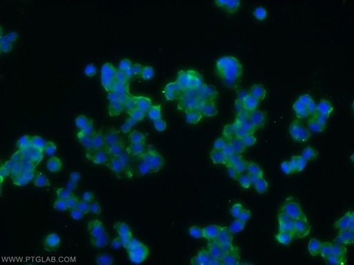 [25060-1-AP-150UL] ARRDC3 Polyclonal antibody