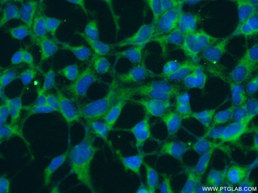 [25061-1-AP-150UL] RNF135 Polyclonal antibody