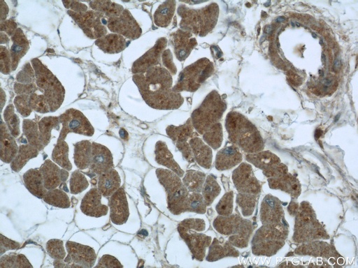 [25068-1-AP-20UL] RIG-1/DDX58 Polyclonal antibody