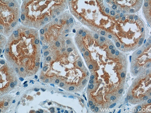 [25070-1-AP-150UL] OTUD4 Polyclonal antibody