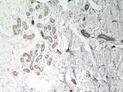 [25071-1-AP-150UL] TGM5 Polyclonal antibody