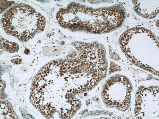 [25072-1-AP-20UL] DNAH14 Polyclonal antibody