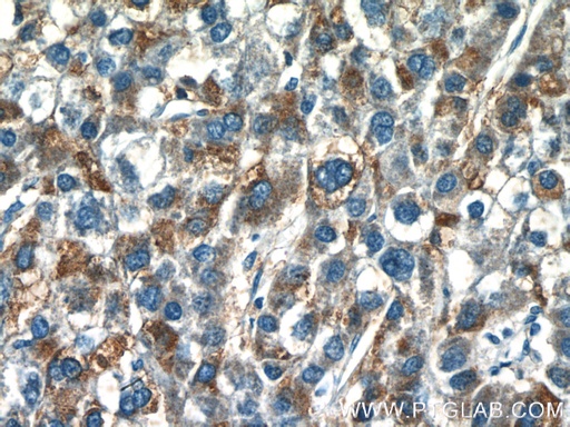 [25074-1-AP-20UL] GDPD2 Polyclonal antibody