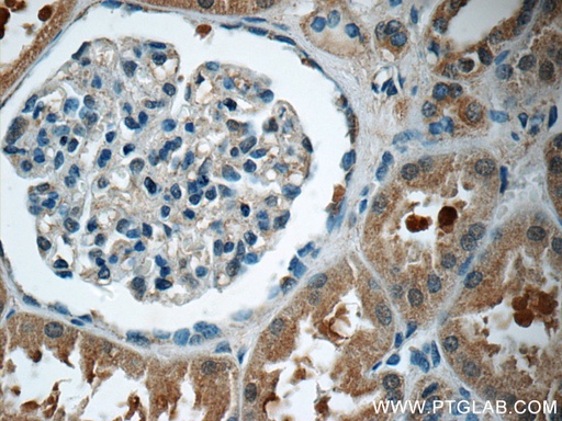 [25079-1-AP-20UL] GNE Polyclonal antibody