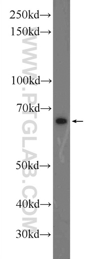 [25083-1-AP-150UL] TTC26 Polyclonal antibody
