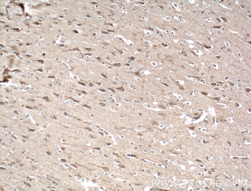 [25086-1-AP-20UL] SIPA1L1 Polyclonal antibody