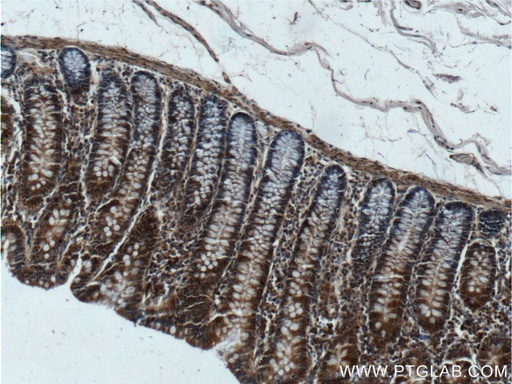 [25087-1-AP-20UL] DOCK6 Polyclonal antibody