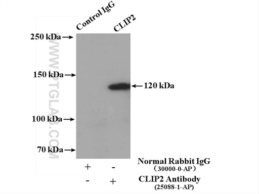 [25088-1-AP-150UL] CLIP-115/CLIP2 Polyclonal antibody