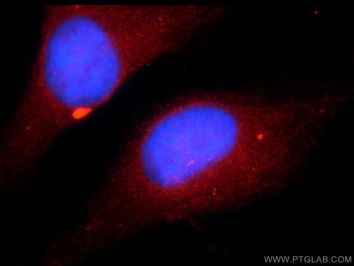 [25094-1-AP-20UL] ZNF277 Polyclonal antibody