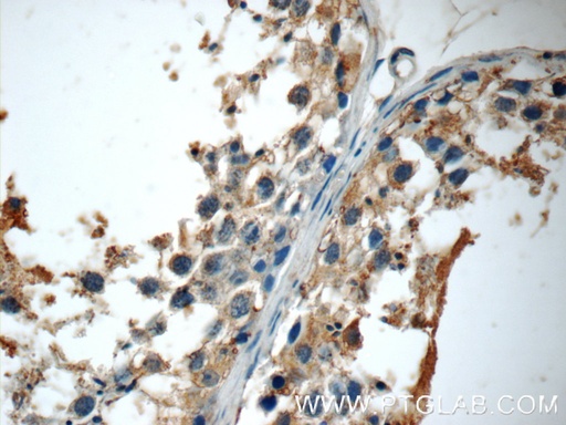 [25097-1-AP-20UL] ODF3 Polyclonal antibody