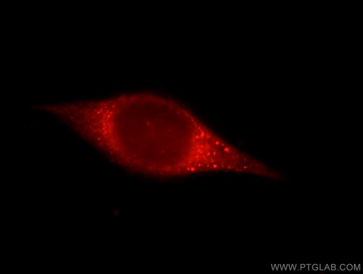 [25098-1-AP-20UL] JMY Polyclonal antibody