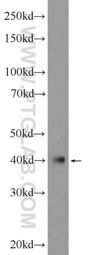[25099-1-AP-20UL] ATXN3L Polyclonal antibody