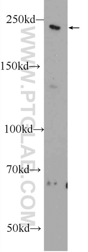 [25104-1-AP-20UL] MYO16 Polyclonal antibody