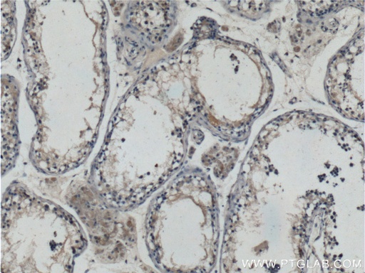 [25107-1-AP-20UL] HIPK3 Polyclonal antibody